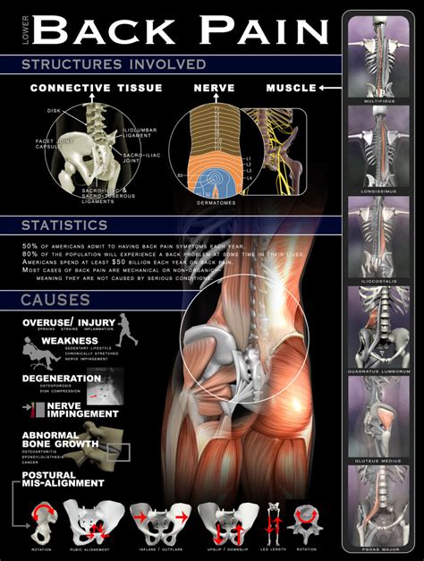 Lower back muscles diagram human back muscles anatomy on human. Infographics & Posters - Real Bodywork
