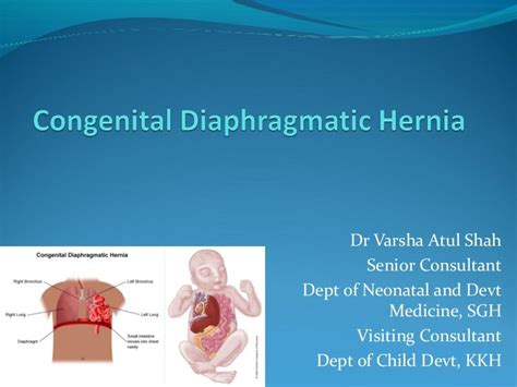Congenital Diaphragmatic Hernia By Dr Varsha Atul Shah