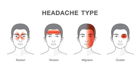 Learn These Important Headache Types Before They Get Dangerous