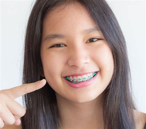 Braces For Kids Precision Orthodontics And Pediatric Dentistry Reston