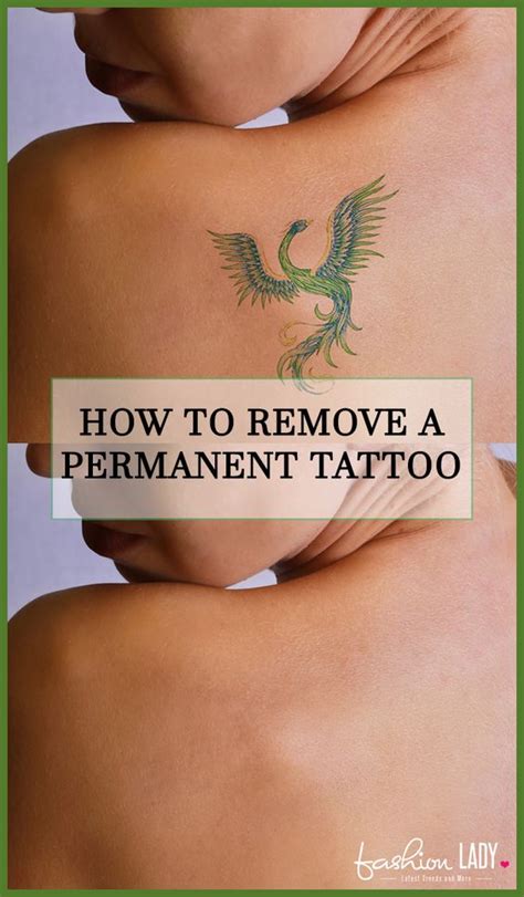 Moreover, there are even fewer chances of fading of ink due to sunlight. How To Remove A Permanent Tattoo: DIY Methods and Surgical ...