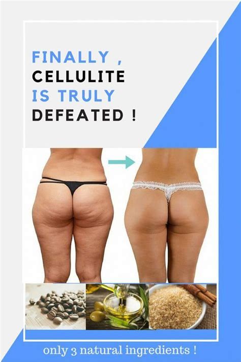 pin on most effective cellulite removal