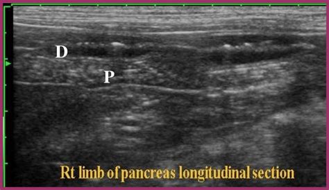 Ultrasound Longitudinal Scan In A Dog Right Limb Of The Pancreas P