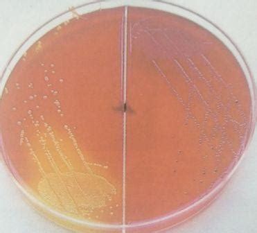 The material used to indicate hydrogen sulfide by creating a black perciptate. Xylose lysine deoxycholate (XLD) agar: Composition ...