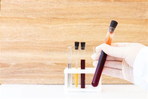 Blood In Test Tubes Laboratory For Taking Blood Tests Coronovirus