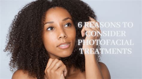 Photofacial Treatments And 6 Reasons Why You Need To Consider Them