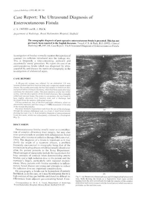 PDF Case Report The Ultrasound Diagnosis Of Enterocutaneous Fistula