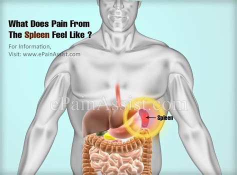 Check spelling or type a new query. What Does Pain From The Spleen Feel Like & Can A Person ...