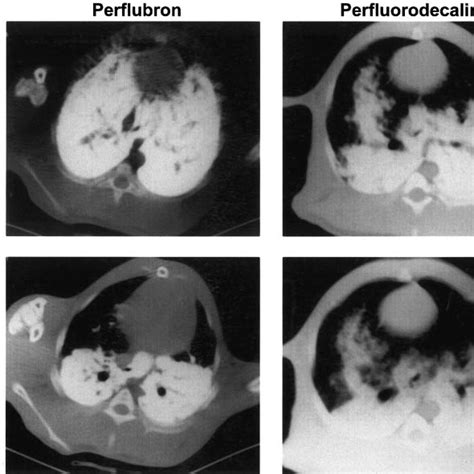 Serial Computerized Tomography Images Of Individual Rabbits During