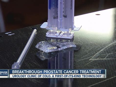 Denver S Breakthrough Prostate Cancer Treatment
