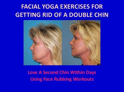 Non Surgical Options For Improving The Appearance Of Your Chin And
