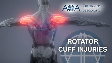 AOA Orthopedic Specialists Rotator Cuff Injuries YouTube