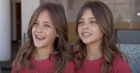 The ‘worlds Most Beautiful Twins — Ava Marie And Leah Rose — Are