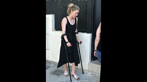 Amber Heard Spotted With Crutches In Madrid Amberheard Youtube