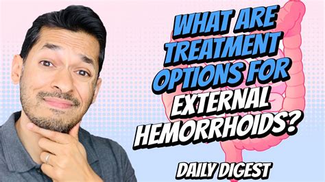 what are treatment options for external hemorrhoids youtube