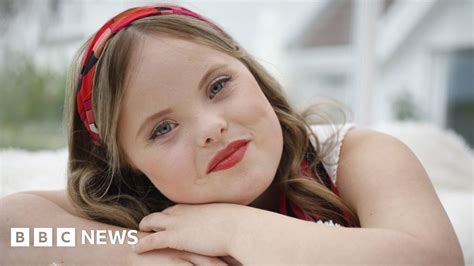Downs Syndrome Swansea Model Beth Matthews Signs With Agency