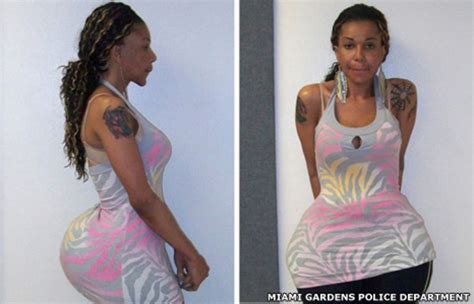 Woman In Miami Denies Cement Buttocks Injection Bbc News