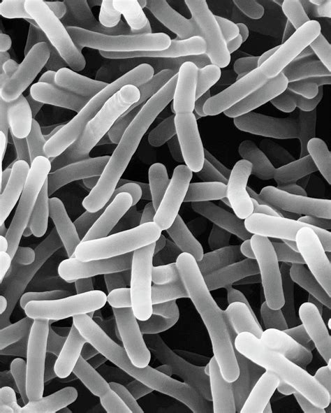 Bifidobacterium Animalis Photograph By Dennis Kunkel Microscopyscience