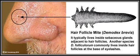 Hair Follicle Parasite