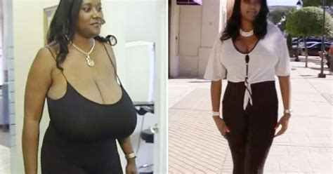 Woman Who Had Surgery To Reduce NNN Breasts Says I Couldn T Even Run Or Jump Mirror Online