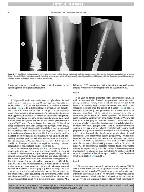 Solution Tapered Modular Fluted Titanium Stems For Femoral Fixation In