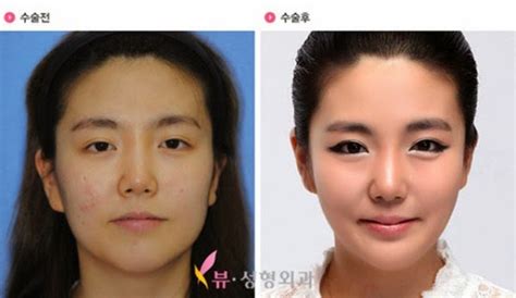 South Korea Plastic Surgery Funnymadworld