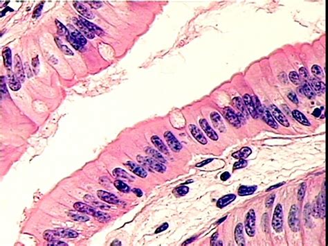 Simple Columnar Epithelium Located In The Small Intestine Note Goblet Cells And Microvilli