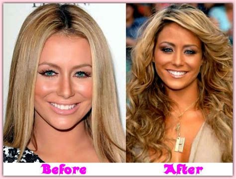 Pictures Aubrey Oday Plastic Surgery Before And After Breast Implants
