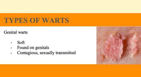 Genital Warts What Is It What Does It Look Like Identify Genital