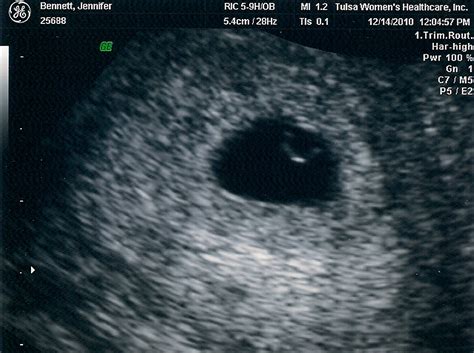 The Bennett Life First Ultrasound