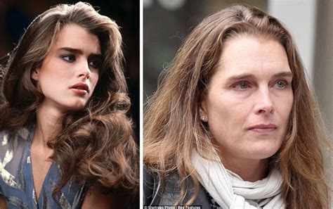Brooke Shields Brooke Shields Plastic Surgery Before And After The