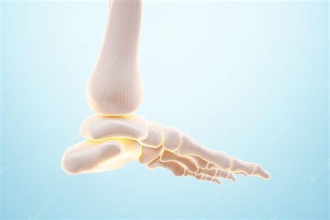 Imagen De Póster Médico De Los Huesos Del Pie Artritis Inflamación