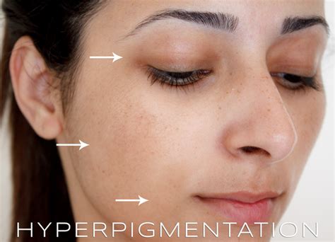 Please do look at that before hitting submit. What are the best medicines for dark spots on the face? I ...