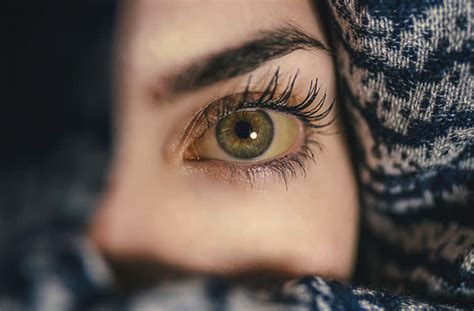Yellow Eyes Causes And Treatment