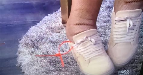 Wendy Williams Shares Close Up Of Severely Swollen Ankles And Admits