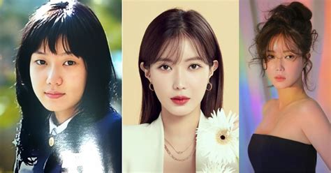 Im Soo Hyang Plastic Surgery Shocking Before And After Looks