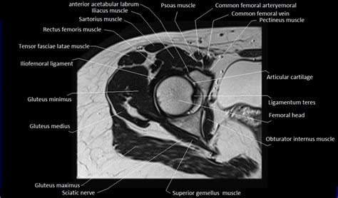 Mri Anatomy Of Hip Joint Free Mri Axial Hip Anatomy