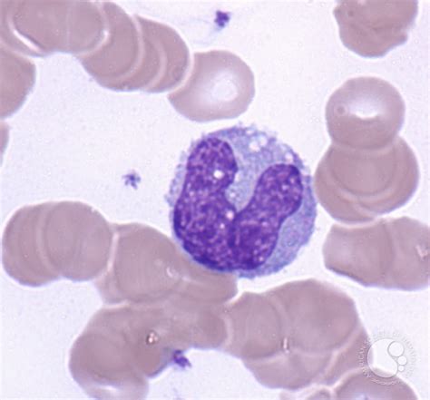 Monocytes 3