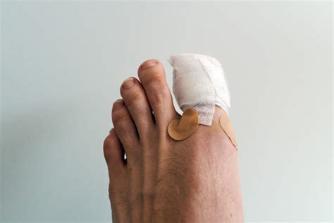 What To Do About Toenail Trauma And Injuries Banner Health