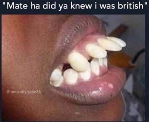 🤦‍♂️ British People Don T Actually Have Bad Teeth R Facepalm