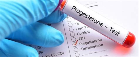 Progesteron testi ne işe yarar arşivleri Doç Dr Çağlar Helvacıoğlu