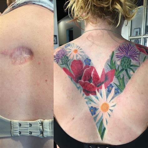 Scar Cover Up By Traci Manley Moms Custom Tattoo In Spokane Wa