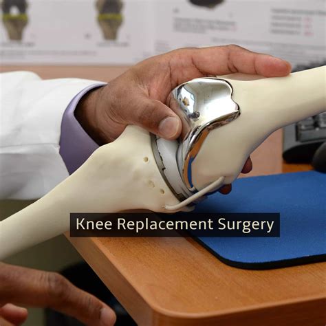 What To Expect After Knee Replacement Surgery The Ami