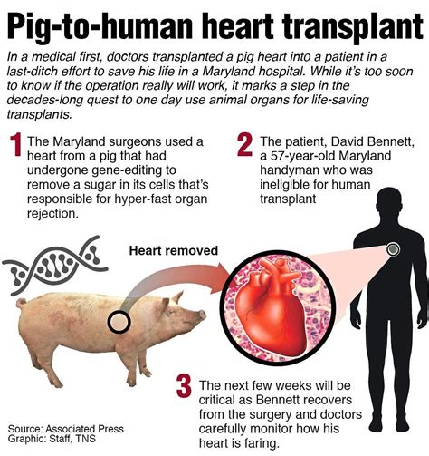 Germans To Do Pig To Human Heart Transplants In Two Years The Star