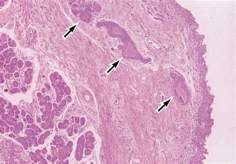 Normal Histology Of The Human Lacrimal Gland The Lobule Has Many Acini