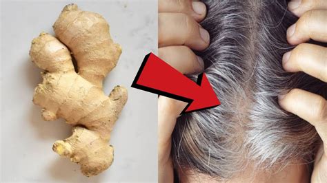 How To Cure Grey Hair White Hair To Black Hair Naturally In 4 Minutes Permanently 100 Work