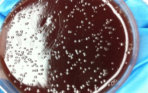 Colonies Of Campylobacter On Blood Agar Download Scientific Diagram
