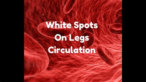 White Spots On Legs Circulation Youtube