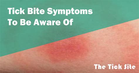 Tick Bite Symptoms To Be Aware Of The Tick Site