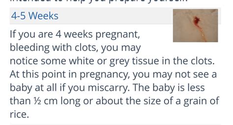 Week Miscarriage Trigger With Pic BabyCenter